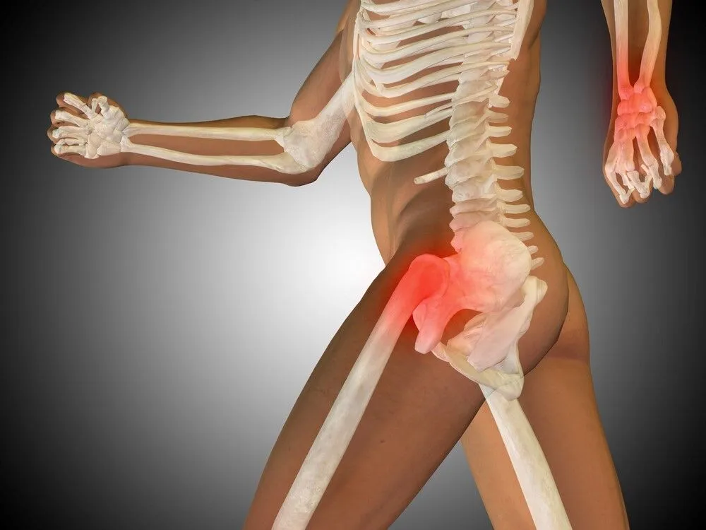 Glut Tendinopathy